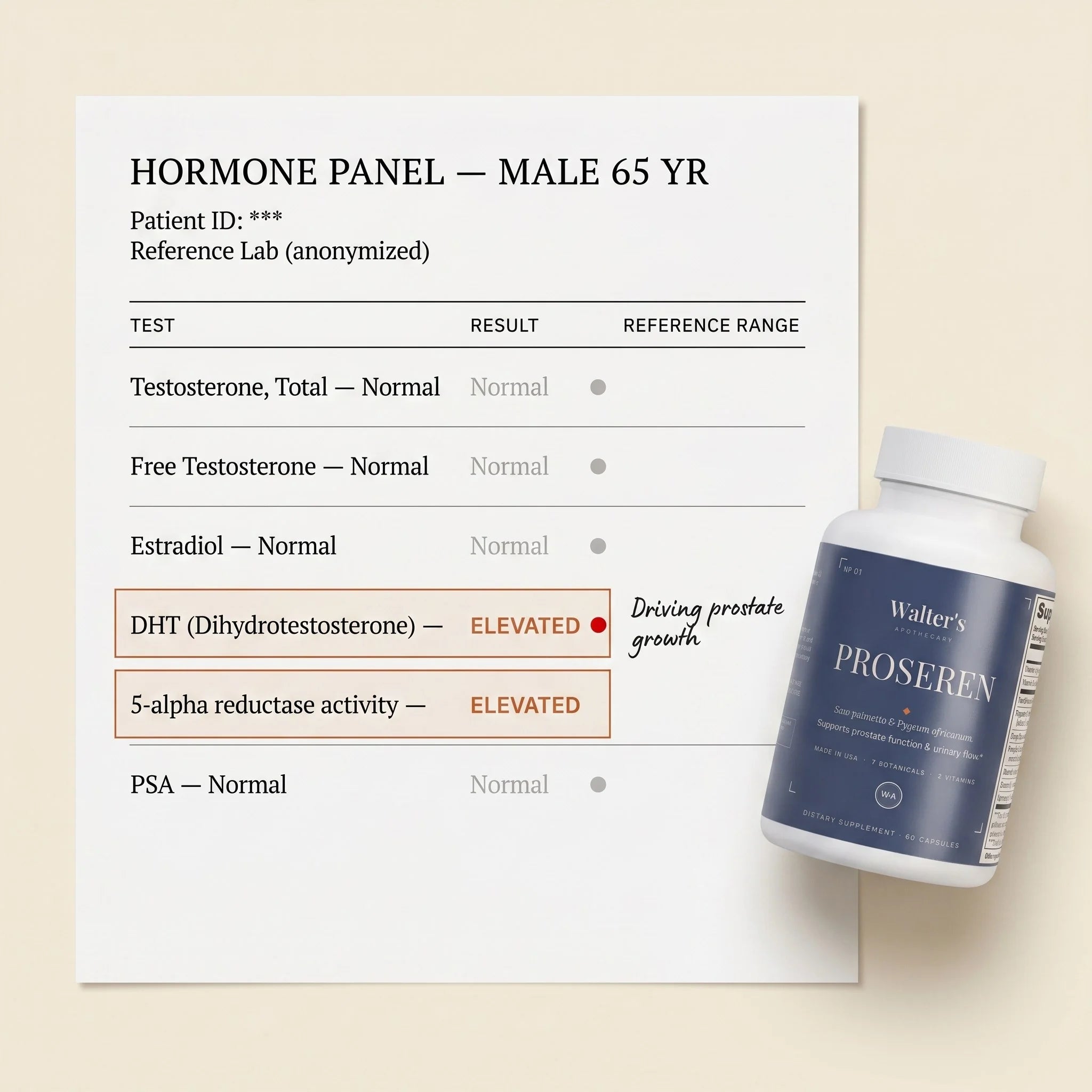 Hormone panel report with DHT elevated, highlighted as the driver of prostate growth